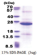 REXO1 (1060-1221, His-tag) Human Protein
