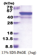MMP-28 (123-520, His-tag) Human Protein
