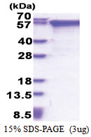 MMP-2 (110-660, His-tag) Human Protein