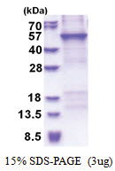 CRTAP (His-tag) Human Protein