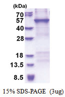 CRTAP (His-tag) Human Protein
