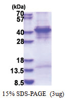 KLF6 (1-283, His-tag) Human Protein KLF6 (1-283, His-tag) Human Protein