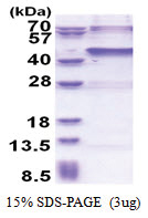 USP46 (1-366, His-tag) Human Protein