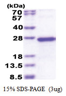 NDUFS5 (1-106, His-tag) Human Protein