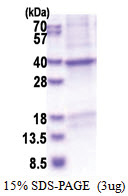 CRHBP (22-322, His-tag) Human Protein