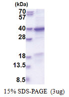 GET4 (1-327, His-tag) Human Protein