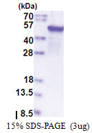 Epoxide hydrolase 1 / EPHX1 (T7 tag) Human Protein