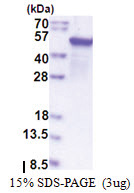 Epoxide hydrolase 1 / EPHX1 (T7 tag) Human Protein