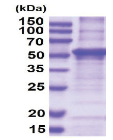 Hemopexin / HPX (24-462, His-tag) Human Protein