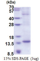 BTF3L4 (1-78, His-tag) Human Protein