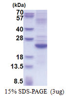 Interleukin-28A / IL28A (26-200, His-tag) Human Protein