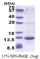 CAMK2N1 (1-78, His-tag) Human Protein