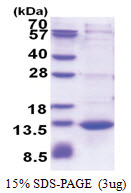 CAMK2N1 (1-78, His-tag) Human Protein