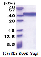 PLEKHF2 (1-249, His-tag) Human Protein