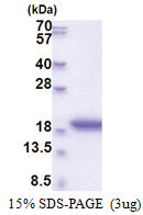 MRFAP1L1 (1-127, His-tag) Human Protein
