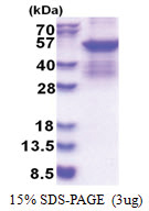 SERPINC1 / Antithrombin-III (33-464, His-tag) Human Protein