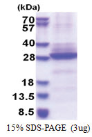 Neuronal acetylcholine receptor subunit alpha-6 (26-239, His-tag) Human Protein