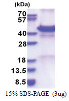 Calreticulin-3 (20-384, His-tag) Human Protein