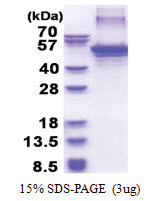 Apolipoprotein J / Apo J (23-449, His-tag) Human Protein