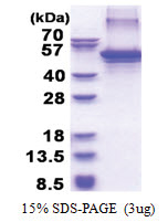 Apolipoprotein J / Apo J (23-449, His-tag) Human Protein