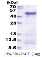 CCDC69 (1-296, His-tag) Human Protein