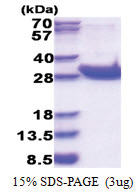 CD45 / LCA (1031-1251, His-tag) Human Protein