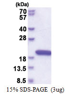 NUDCD2 (1-157, His-tag) Human Protein