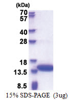 Calponin-2 (1-131, His-tag) Human Protein