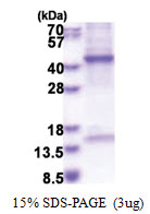 HPR (20-348, His-tag) Human Protein HPR (20-348, His-tag) Human Protein