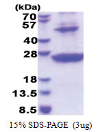 HLA class II DR beta 1 / HLA-DRB1 (30-227, His-tag) Human Protein