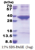 Cathepsin E (57-363, His-tag) Human Protein