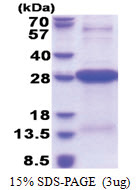 HLA class II DR alpha / HLA-DRA (26-216, His-tag) Human Protein