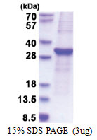 SOCS3 / CIS3 (1-225, His-tag) Human Protein