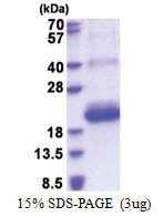 CD164L2 (30-141, His-tag) Human Protein