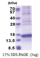 CXCL17 (22-119, His-tag) Human Protein