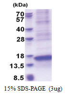 CXCL17 (22-119, His-tag) Human Protein
