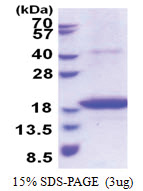 STEAP4 (1-152, His-tag) Human Protein