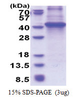 DOK4 (1-326, His-tag) Human Protein