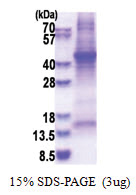 Haptoglobin (19-347, His-tag) Human Protein