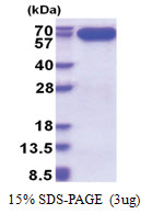 AIFM1 / AIF (98-609, His-tag) Human Protein