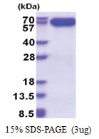 AIFM1 / AIF (98-609, His-tag) Human Protein