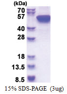 Cytokeratin 16 (1-473, His-tag) Human Protein