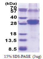 RNF114 (1-228, His-tag) Human Protein