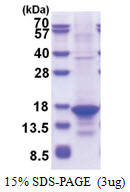 CD256 / APRIL (105-247, T7 tag) Human Protein