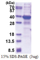 TGIF2LX (1-241, His-tag) Human Protein