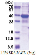 TGIF2LX (1-241, His-tag) Human Protein