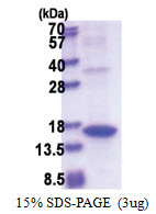 Angiogenin (25-147, His-tag) Human Protein
