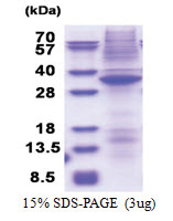 STK17A / DRAK1 (His-tag) Human Protein