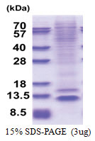 NUP62CL (His-tag) Human Protein