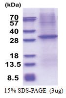 CD1e (His-tag) Human Protein